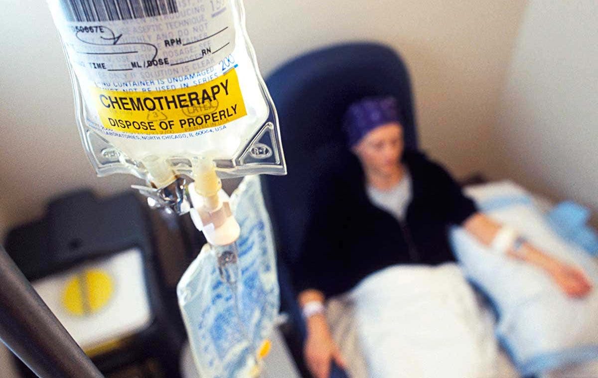 chemotherapy