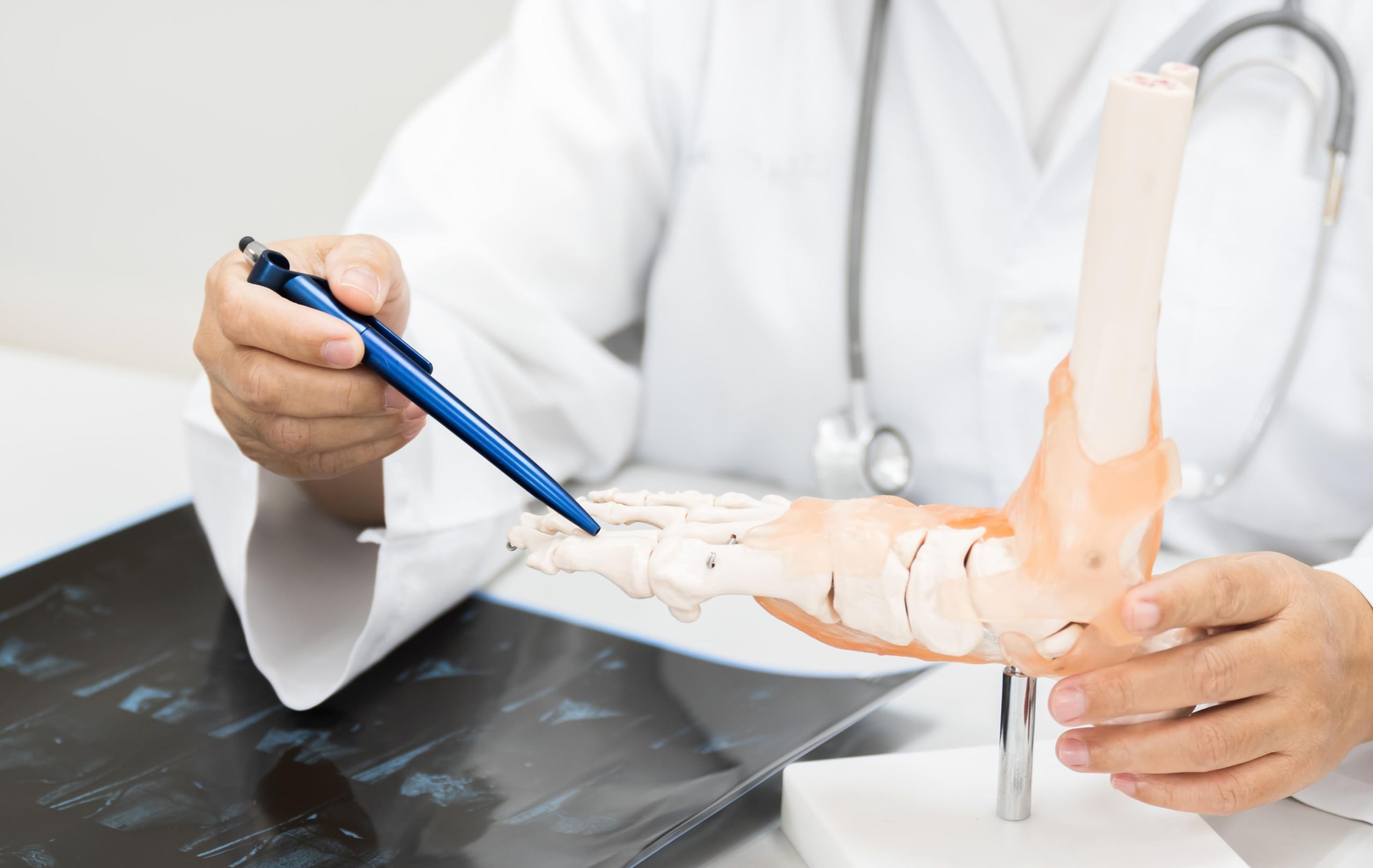 علماء روس يبتكرون براغي قابلة للامتصاص لعلاج الكسور المعقدة