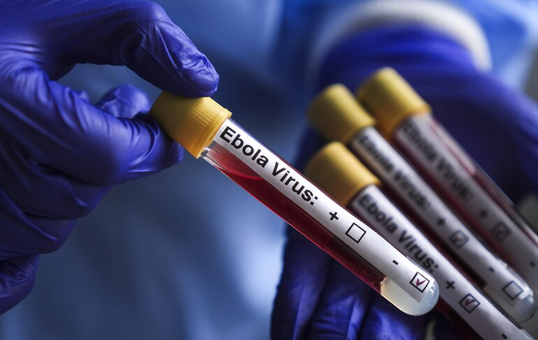 Ebola