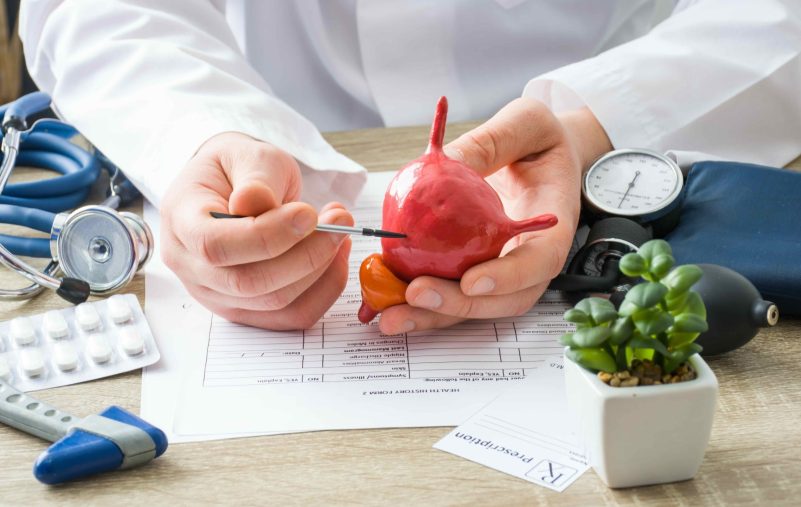 At doctors appointment physician shows to patient shape of urine bladder with focus on hand with organ. Scene explaining patient causes and localization of diseases of bladder and the urinary system